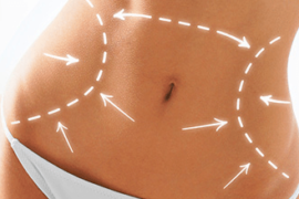When is the Right Time for a Tummy Tuck?